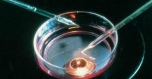 Fecondazione Eterologa